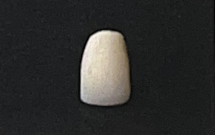 CADプラスチック冠