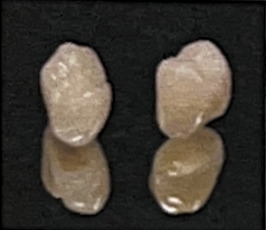 ジルコニアボンド