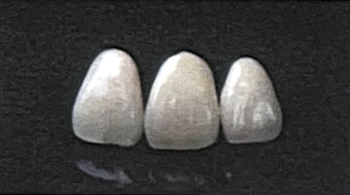 ジルコニアボンドスーパー